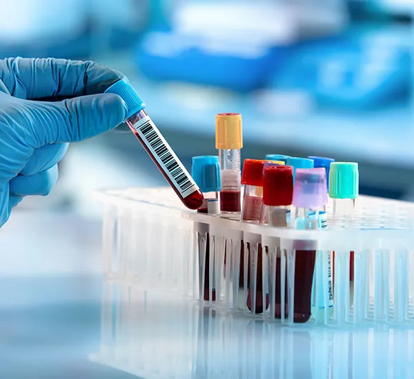 Comprehensive Care for Blood Disorders