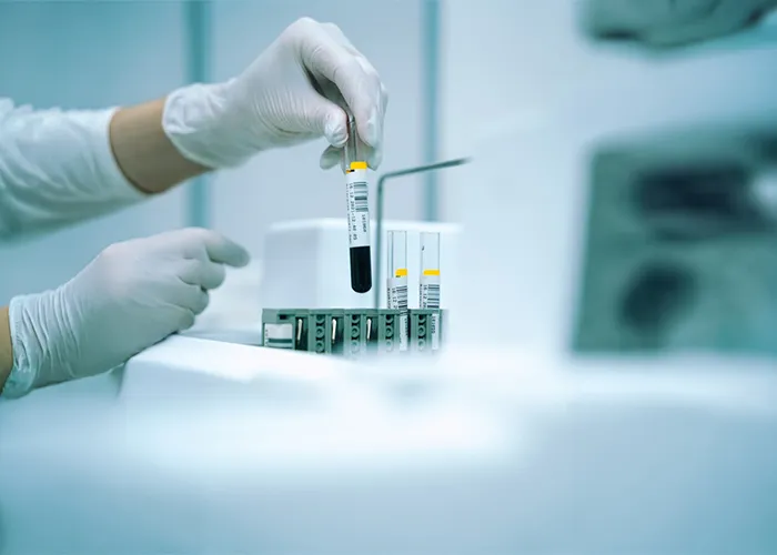Routine Tests
