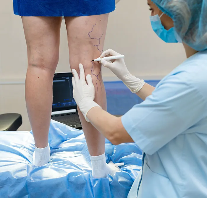 Expert Care for Blood Vessel Health and Circulation